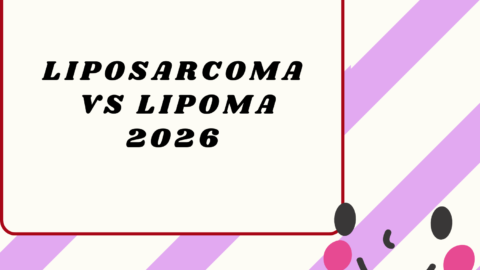 Liposarcoma vs Lipoma2026